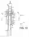 Fig. 11 - Mounting devices for fixation devices and insertion instruments used therewith