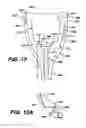 Fig. 09 - Tamp for concave resurfacing prosthesis