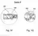 Fig. 04 - Implantation device, applicator and sonotrode