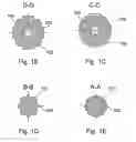Fig. 03 - Implantation device and method for applying the same