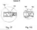 Fig. 04 - Implantation device and method for applying the same