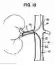 Fig. 05 - Access device