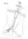 Fig. 22 - Suturing instrument