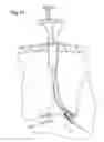 Fig. 23 - Suturing instrument