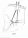 Fig. 24 - Suturing instrument