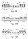 Fig. 13 - Barrier layer with underlying medical device and one or more reinforcing support structures