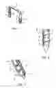 Fig. 02 - SURGICAL CLIP