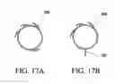 Fig. 12 - Device and method for joining vessels in anastomosis