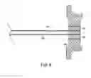 Fig. 06 - Endoscopic Tissue Separator Surgical Device