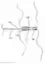 Fig. 01 - METHOD AND DEVICE FOR PREVENTION OF PNEUMOTHORAX DURING VASCULAR ACCESS