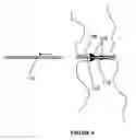 Fig. 09 - METHOD AND DEVICE FOR PREVENTION OF PNEUMOTHORAX DURING VASCULAR ACCESS