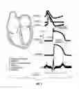 Fig. 03 - METHOD OF TREATING ARRHYTHMIAS