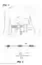 Fig. 02 - Apnea treatment device
