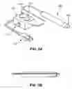 Fig. 03 - Method and apparatus for treating gland dysfunction employing heated medium