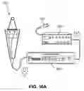 Fig. 09 - Method and apparatus for treating gland dysfunction employing heated medium