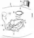 Fig. 04 - Leadless cardiac stimulation systems