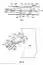 Fig. 08 - Leadless cardiac stimulation systems