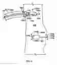 Fig. 09 - Leadless cardiac stimulation systems