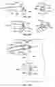 Fig. 17 - Leadless cardiac stimulation systems