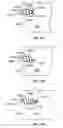 Fig. 18 - Leadless cardiac stimulation systems