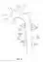 Fig. 02 - Implant for aortic dissection and methods of use