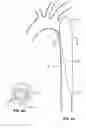 Fig. 06 - Implant for aortic dissection and methods of use