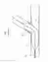 Fig. 02 - Main vessel constraining side-branch access balloon