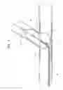 Fig. 05 - Main vessel constraining side-branch access balloon