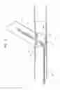 Fig. 06 - Main vessel constraining side-branch access balloon