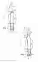 Fig. 02 - Intraoperative Anastomosis Method