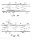 Fig. 15 - Intraoperative Anastomosis Method