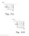Fig. 27 - Intraoperative Anastomosis Method