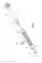 Fig. 04 - Medical device delivery system