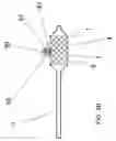 Fig. 08 - Adjustable bifurcation catheter incorporating electroactive polymer and methods of making and using the same
