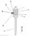 Fig. 09 - Adjustable bifurcation catheter incorporating electroactive polymer and methods of making and using the same
