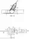Fig. 03 - Side branch stenting system using a main vessel constraining side branch access balloon and side branching stent