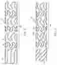 Fig. 06 - Side branch stenting system using a main vessel constraining side branch access balloon and side branching stent
