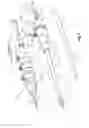 Fig. 02 - Endovascular delivery device