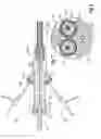 Fig. 06 - Endovascular delivery device