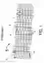 Fig. 02 - Stent with optimal strength and radiopacity characteristics