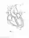 Fig. 02 - Nonstented temporary valve for cardiovascular therapy