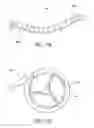 Fig. 27 - Nonstented temporary valve for cardiovascular therapy
