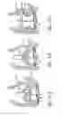 Fig. 70 - Nonstented temporary valve for cardiovascular therapy