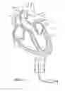 Fig. 78 - Nonstented temporary valve for cardiovascular therapy