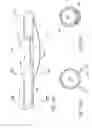 Fig. 81 - Nonstented temporary valve for cardiovascular therapy