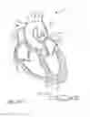 Fig. 87 - Nonstented temporary valve for cardiovascular therapy