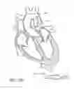 Fig. 88 - Nonstented temporary valve for cardiovascular therapy
