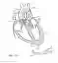 Fig. 91 - Nonstented temporary valve for cardiovascular therapy