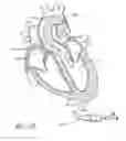 Fig. 94 - Nonstented temporary valve for cardiovascular therapy