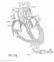Fig. 95 - Nonstented temporary valve for cardiovascular therapy